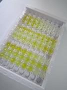17-羟孕酮(17-OHP)检测试剂盒(酶联免疫吸附试验法)
