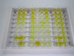 氨基端前脑钠素(NT-ProBNP)检测试剂盒(酶联免疫吸附试验法)