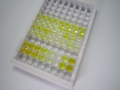 氨基端前脑钠素(NT-ProBNP)检测试剂盒(酶联免疫吸附试验法)
