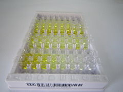 Ⅰ型胶原交联氨基端肽(NTXI)检测试剂盒(酶联免疫吸附试验法)