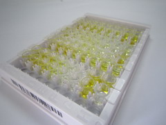 Ⅰ型胶原交联氨基端肽(NTXI)检测试剂盒(酶联免疫吸附试验法)