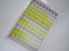 分泌型免疫球蛋白A(sIgA)检测试剂盒(酶联免疫吸附试验法)