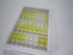 神经介素B(NMB)检测试剂盒(酶联免疫吸附试验法)