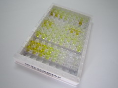 促腎上腺皮質(zhì)激素(ACTH)檢測試劑盒(酶聯(lián)免疫吸附試驗法)