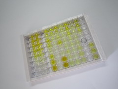 促肾上腺皮质激素(ACTH)检测试剂盒(酶联免疫吸附试验法)
