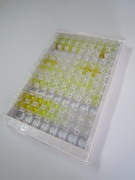 淀粉样蛋白β1-40(Ab1-40)检测试剂盒(酶联免疫吸附试验法)