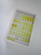 淀粉样蛋白β1-40(Ab1-40)检测试剂盒(酶联免疫吸附试验法)