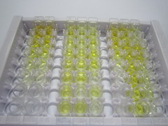 淀粉樣蛋白β1-40(Ab1-40)檢測(cè)試劑盒(酶聯(lián)免疫吸附試驗(yàn)法)