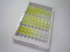 甲状旁腺激素(PTH)检测试剂盒(酶联免疫吸附试验法)