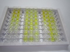 降钙素基因相关肽(CGRP)检测试剂盒(酶联免疫吸附试验法)