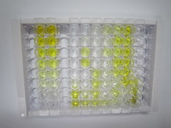 氰钴胺素(CNCbl)检测试剂盒(酶联免疫吸附试验法)