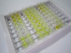 Ⅰ型前胶原氨基端原肽(PINP)检测试剂盒(酶联免疫吸附试验法)