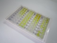饥饿素(GHRL)检测试剂盒(酶联免疫吸附试验法)