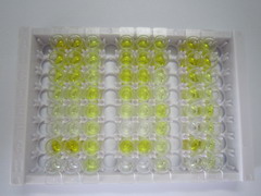 胃泌素释放肽前体(ProGRP)检测试剂盒(酶联免疫吸附试验法)