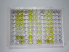 胸腺素β4(TMSB4X)檢測試劑盒(酶聯(lián)免疫吸附試驗法)