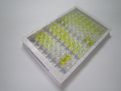 反三碘甲状腺原氨酸(rT3)检测试剂盒(酶联免疫吸附试验法)