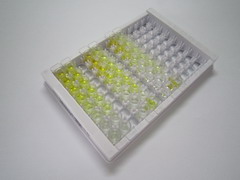 吻素1(KISS1)检测试剂盒(酶联免疫吸附试验法)