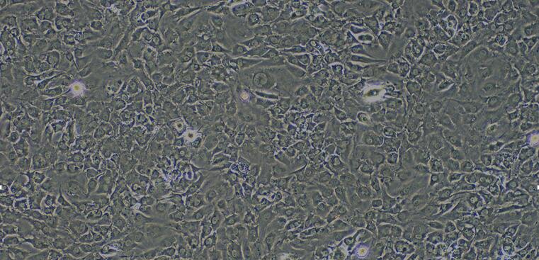 兔心脏微血管内皮细胞(CMEC)原代细胞