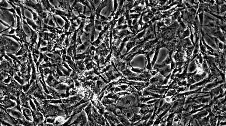 小鼠主动脉内皮细胞(AEC)原代细胞
