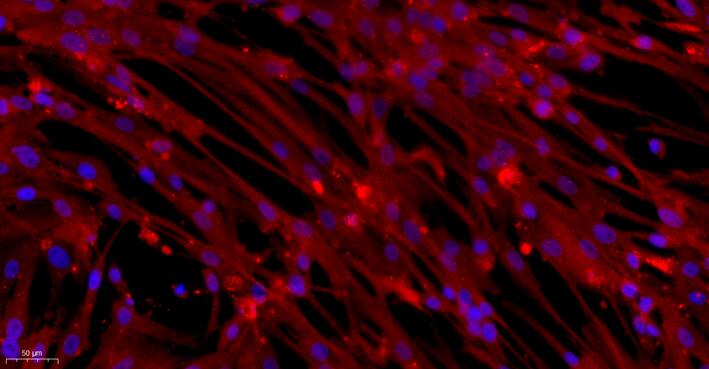 小鼠主动脉内皮细胞(AEC)原代细胞