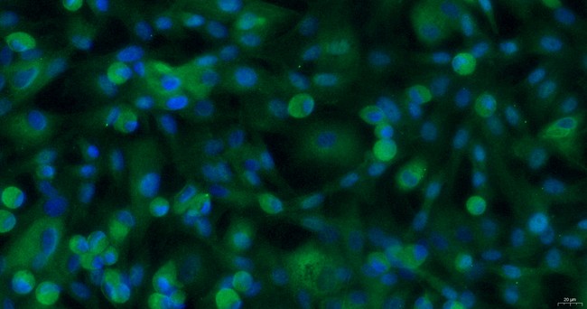 犬视网膜星形细胞(RA)原代细胞