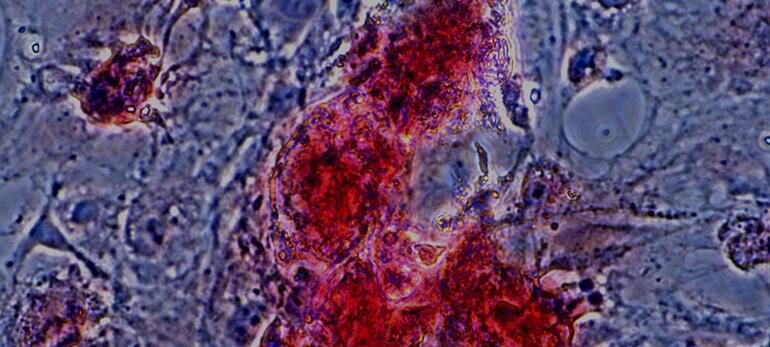 小鼠皮下脂肪前体细胞(SPrAD)原代细胞