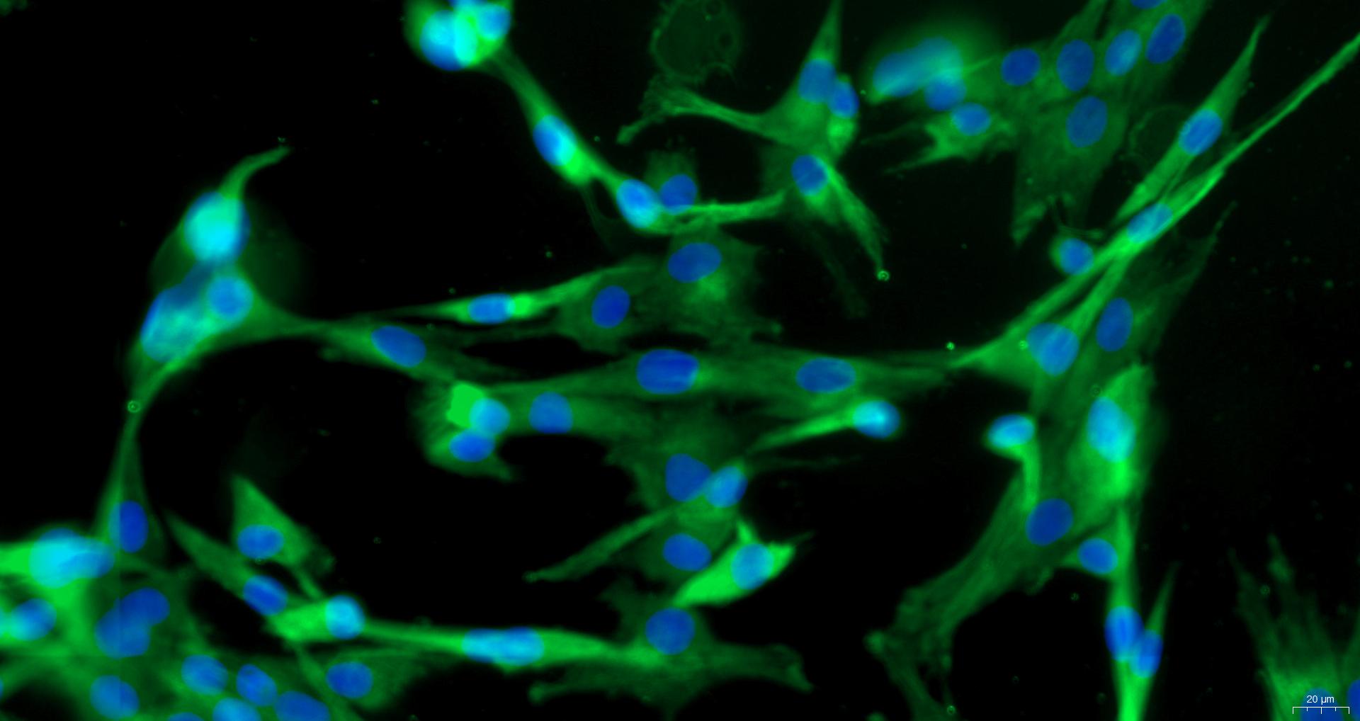 小鼠肺成纤维细胞(PF)原代细胞