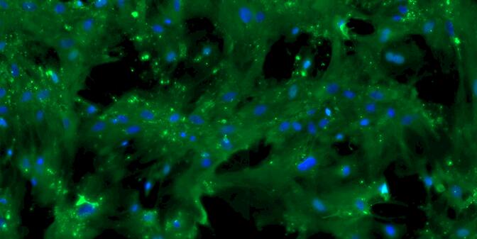 小鼠子宫平滑肌细胞(USMC)原代细胞