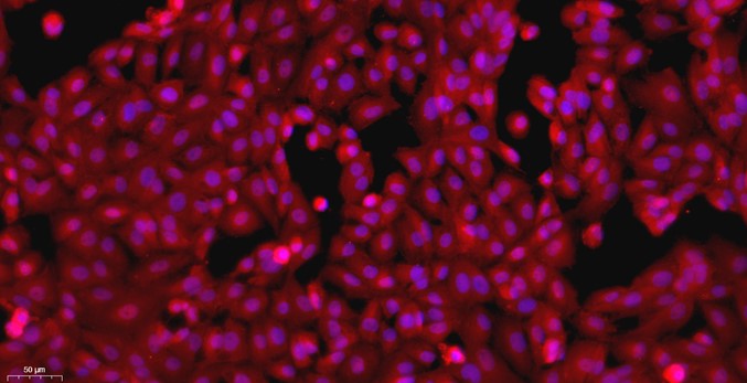 大鼠肾小管上皮细胞(RTEC)原代细胞