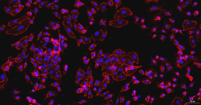 大鼠肾小管上皮细胞(RTEC)原代细胞