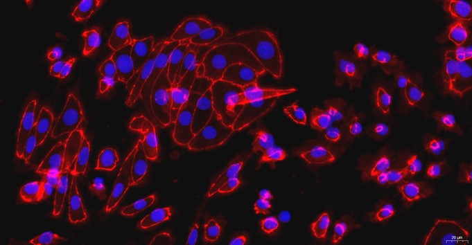 大鼠肾小管上皮细胞(RTEC)原代细胞