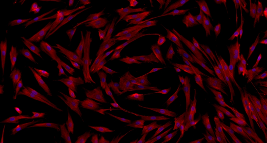 小鼠膀胱基质成纤维细胞(BSF)原代细胞