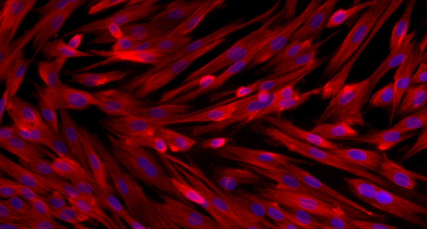 大鼠膀胱基质成纤维细胞(BSF)原代细胞
