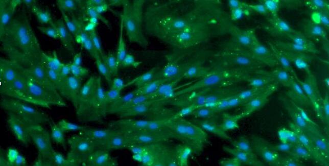 猪气管平滑肌细胞(TSMC)原代细胞