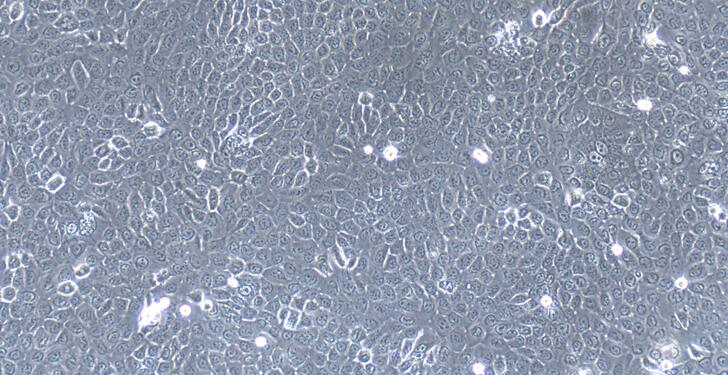 小鼠新生儿表皮角质形成细胞(NEK)原代细胞