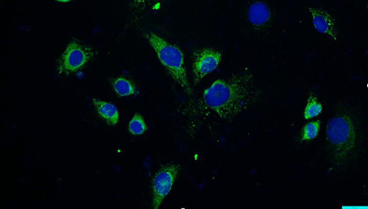 小鼠成骨细胞(OB)原代细胞