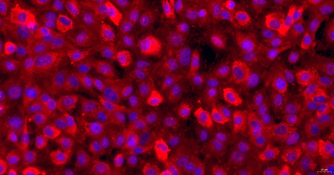 小鼠成骨细胞(OB)原代细胞