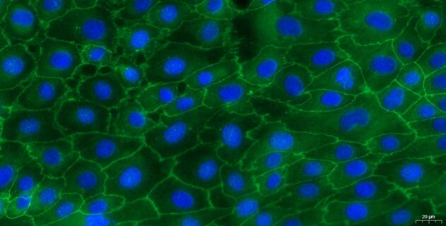小鼠结肠上皮细胞(CEC)原代细胞