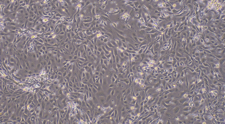 小鼠宫颈上皮细胞(CrEC)原代细胞