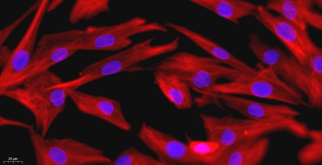 小鼠滑膜细胞(SYC)原代细胞