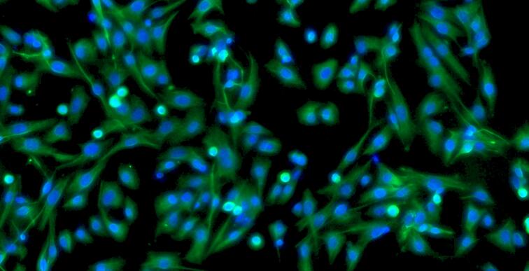 小鼠脂肪微血管内皮细胞(AMEC)原代细胞