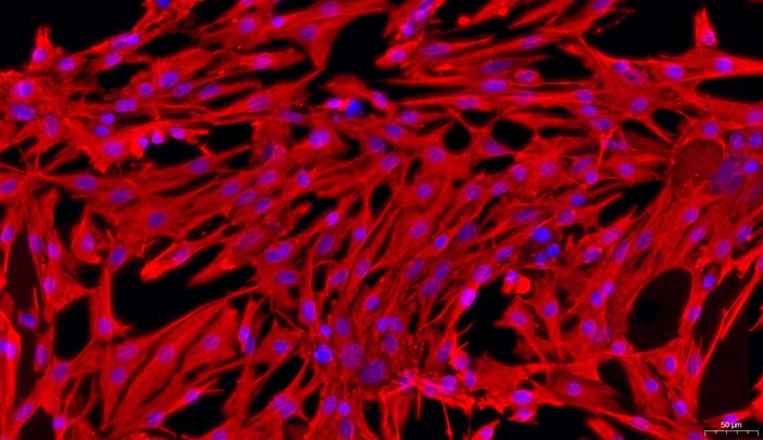 兔前列腺成纤维细胞(PF)原代细胞