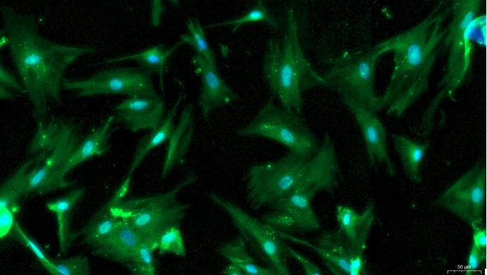 大鼠胰腺星状细胞(PaSC)原代细胞