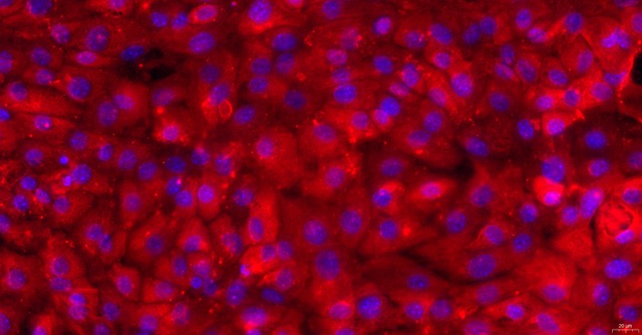 小鼠精囊上皮细胞(SVEC)原代细胞