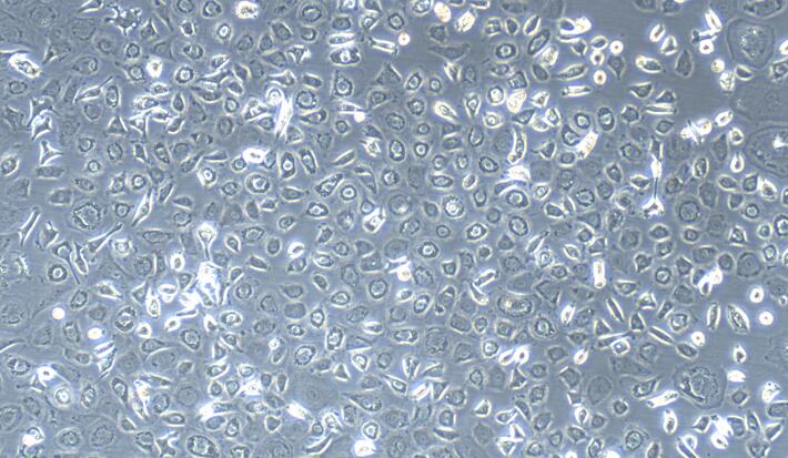 兔腹膜间皮细胞(PMC)原代细胞