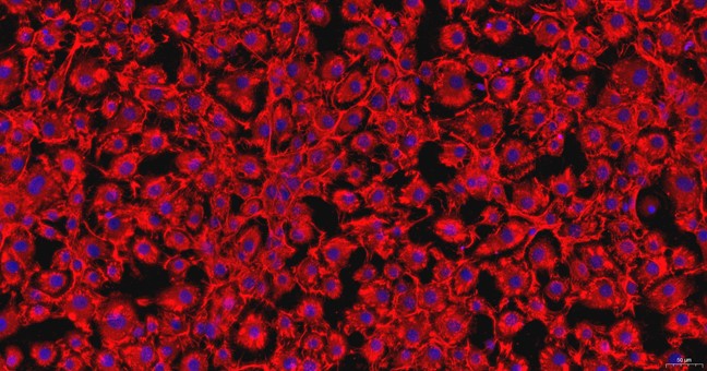 小鼠角膜基質(zhì)細(xì)胞(CSC)原代細(xì)胞