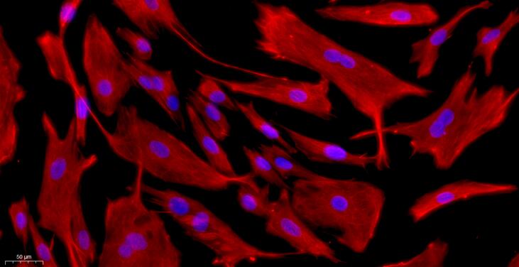 兔角膜基质细胞(CSC)原代细胞