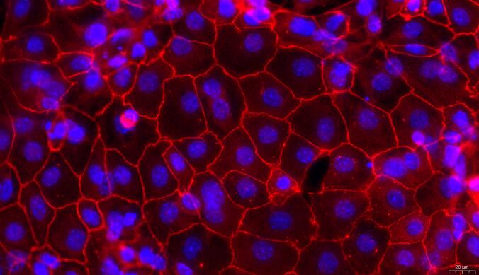 小鼠输卵管上皮细胞(TuEC)原代细胞