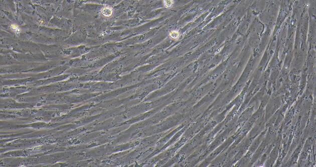 犬心脏瓣膜间质细胞(CVIC)原代细胞