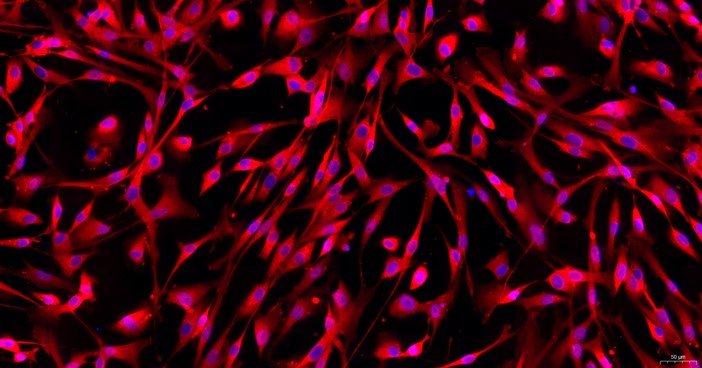 猫主动脉血管外膜成纤维细胞(AAF)原代细胞